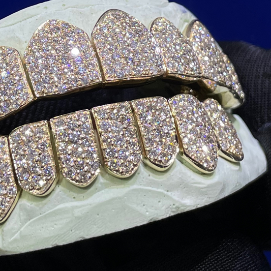 Custom Diamond Teeth